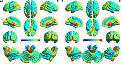 Frequency-specific alterations in intrinsic low-frequency oscillations in newly diagnosed male patients with obstructive sleep apnea